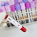 blood-sample-that-is-hepatitis-b-positive.jpg