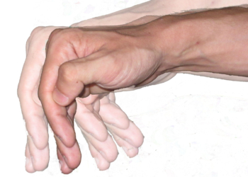temblor-mano_mb8.jpg