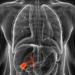 colangitis-esclerosante.jpg
