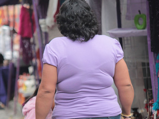 cirrosis-y-obesidad.jpg