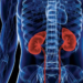 falla-renal.jpg