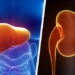 hígado-y-riñón-hepatitis-2000.jpg