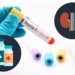 rinon_hepatitis-C-730x487.jpg
