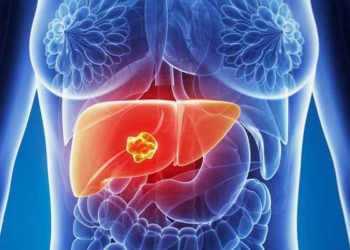 Cancer-de-higado-sintomas-iniciales-y-tratamientos.jpg