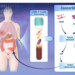 Hepatitis-2000CancerSEEK-blood-test-that-detects-8-common-cancers.png