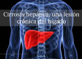 cirrosis-hepatica.jpg