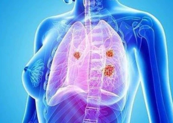 fármaco-cáncer-pulmón.jpg