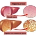 higado-graso222.jpg