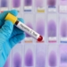 hepatitis-Ctestespaña.jpg