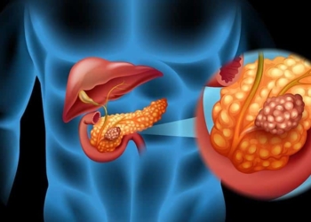 img_efreire_20190406-103159_imagenes_lv_terceros_cancer_pancreas-k24C-U461478700829XHI-992x558@LaVanguardia-Web.jpg
