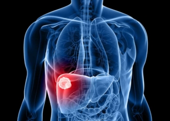 Cancer-de-higado.jpg