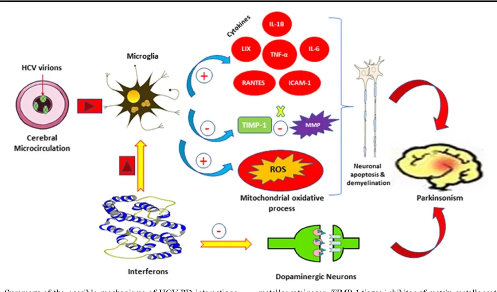 Parkinson.Resumen de los posibles mecanismos de las interacciones HCV-PD.