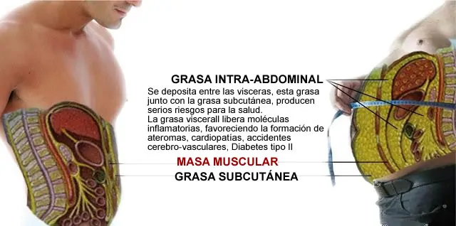 imagen de grasa intrabdominal