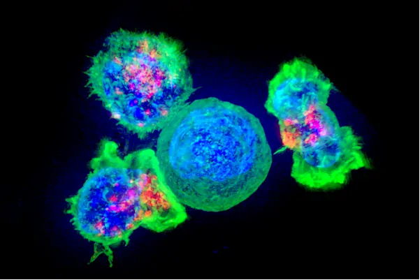 células T frente a la infección