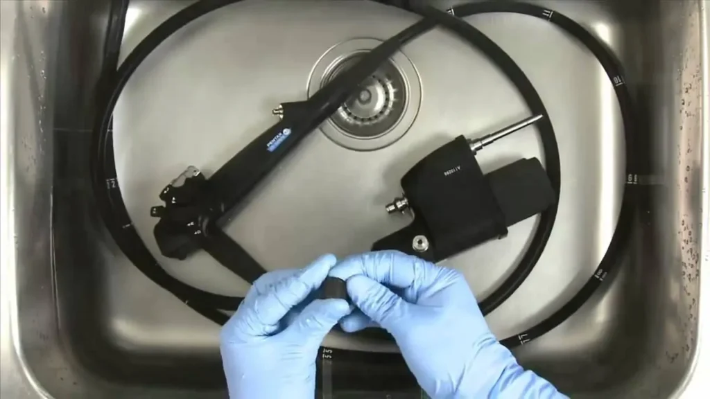 hepatitis higiene endoscopio