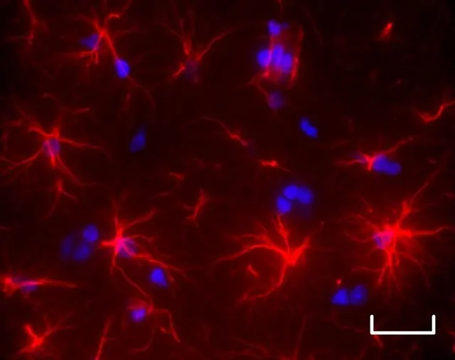 células astrocíticas (rojas), del cerebro de ratones, muestran una morfología alterada