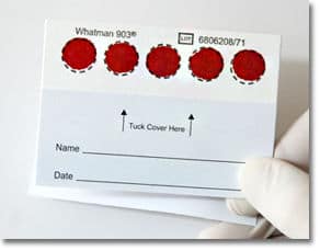 ejemplo de  muestra de sangre DBS