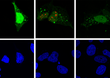 La replicación del virus de la hepatitis D (rojo) induce autofagia (verde) en la célula huésped
