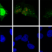 La replicación del virus de la hepatitis D (rojo) induce autofagia (verde) en la célula huésped