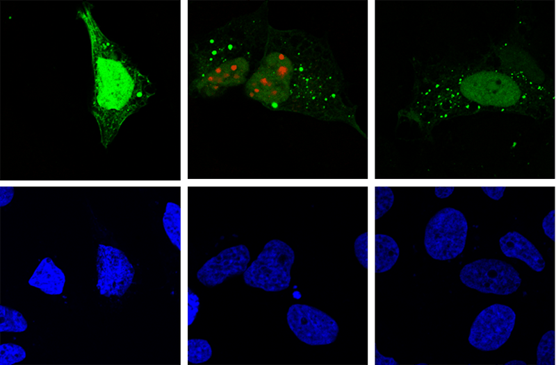  La replicación del virus de la hepatitis D (rojo) induce autofagia (verde) en la célula huésped