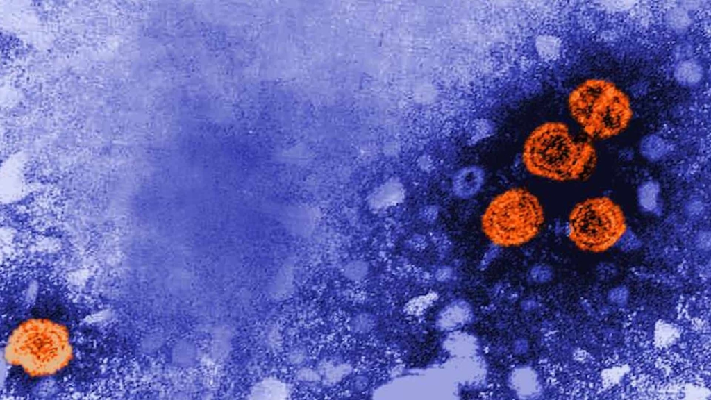 La imagen microscópica electrónica de transmisión coloreada digitalmente revela la presencia de viriones de hepatitis B (color naranja).© CDC / Dr. Erskine Palmer