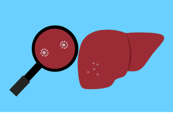 durante 2020 se registraron 3978 casos de hepatitis a en mexico