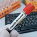 hepatitis d