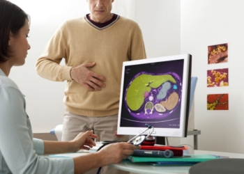 cirrosis higado 2