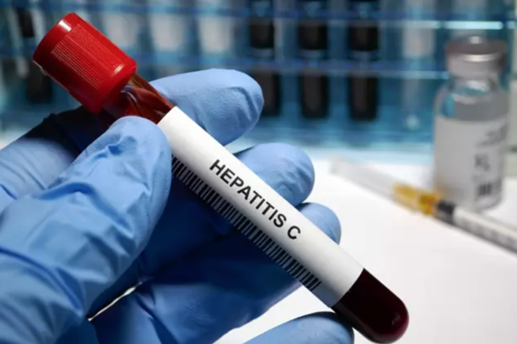 tubo de ensayo con análisis para hepatitis C
