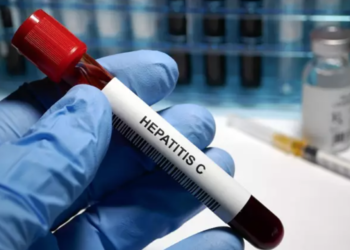 hepatitis C