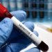 hepatitis C