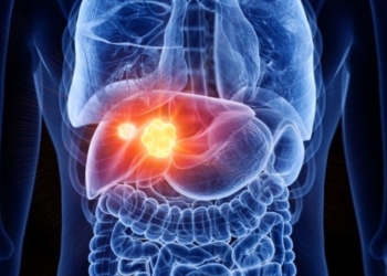 ¿que es la hepatitis autoinmune 1