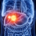 ¿que es la hepatitis autoinmune 1