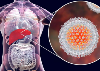 Hepatitis Viral y Salud Pública: Un Desafío para su Eliminación